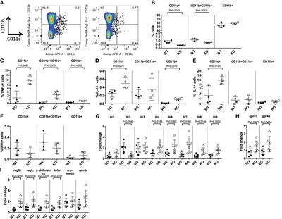 TLR5-deficiency controls dendritic cell subset development in an autoimmune diabetes-susceptible model